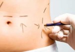 cirurgia-plastica-em-jacarei-1442261255